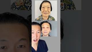 Plastic Surgeon or Menace TikTok’s Dr Kim Results [upl. by Earb747]