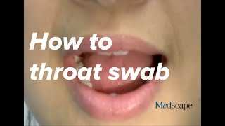 How to perform a throat swab on a patient [upl. by Arvonio]