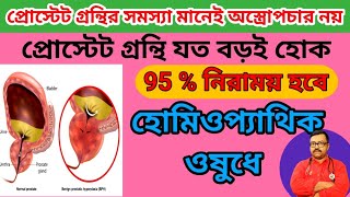 প্রস্টেট গ্রন্থির হোমিও ঔষধ  Enlarged prostate homeopathic treatment  Homeopathic Medicine [upl. by Davie]