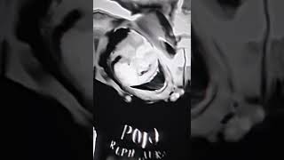 MANGOS PHONKtiktok versiónEDIT edit videos phonk [upl. by Yelraf42]