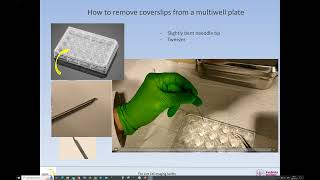 Removing coverslips from a 24 well plate [upl. by Radec]