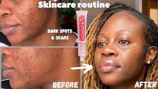 Get rid of dark spots with one product Faded by Topicals review [upl. by Arayc]