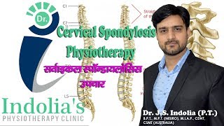 गर्दन दर्द का कारण cervical spondylitis neck pain [upl. by Troth]