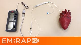 Placing a Transvenous Pacemaker [upl. by Harrat]