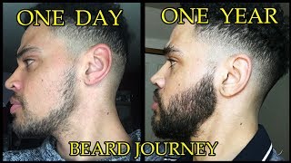 ONE YEAR TRANSFORMATION My Minoxidil Beard Journey  Whats To Come in 2020 [upl. by Garate884]