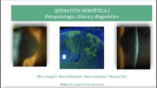 Fisiopatología Clinica y Diagnóstico de la Queratitis Herpética Queratitis Herpética I [upl. by Ssidnac]