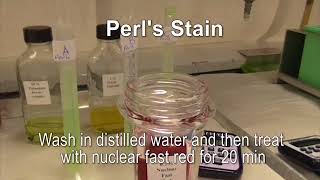 Perls stain for hemosiderin [upl. by Vola]