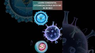 Learn Congenital Cytomegalovirus in 30 sec🦠neetpg virus microbiology tricks mbbs [upl. by Mcgrath]