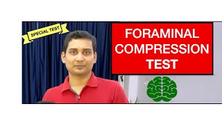 Foraminal Compression Test or Spurlings Test Cervical Radicular Syndrome [upl. by Anurag575]