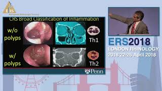 ERS London 2018 The Role Of Bitter Taste Receptors In Predicting Outcomes In CRS Noam Cohen [upl. by Hike138]