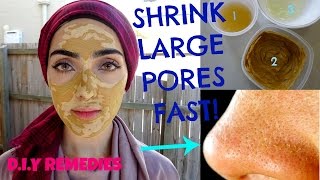 How To Get Rid of Large Pores  Get Tighter amp Smooth Skin Naturally  Shrink Pores FAST  Immy [upl. by Mallen]