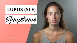 Lupus Symptome der Autoimmunerkrankung [upl. by Ross]