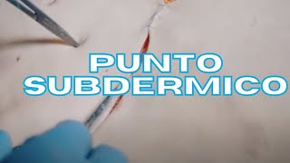 Cómo HACER el PUNTO subdermico  técnica quirúrgica [upl. by Blessington]