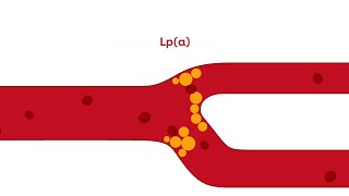 What is Lipoprotein a [upl. by Aziar]