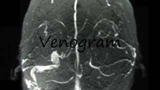 How to Pronounce Venogram [upl. by Roxine474]