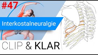 Interkostalneuralgie erklärt  ZwischenRippenNervenschmerz [upl. by Nilyak]