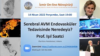 İON 229 Lecture Saatçi Serebral AVM Endovasküler Tedavisinde Nerdeyiz 140422 [upl. by Repsaj]