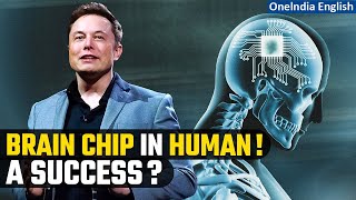 Elon Musks Neuralink aims to connect brains to computers introduces 1st wireless chip implant [upl. by Corey]