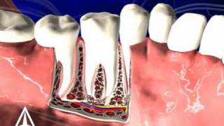 Tooth Anatomy  3D Medical Animation [upl. by Tacy750]