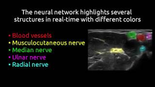 Highlighting nerves and blood vessels for ultrasound axillary nerve blocks using neural networks [upl. by Avahc]