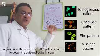 Antinuclear antibody ANA I Understand the test [upl. by Navad]