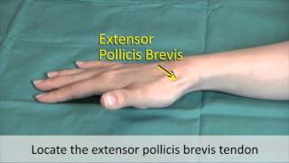 Musculoskeletal Examination and Joint Injection Series DeQuervains Tenosynovitis Injection [upl. by Oznole469]