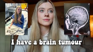 I have a large brain tumour How they found it my signs and symptoms [upl. by Hailat158]