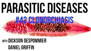 Parasitic Diseases Lectures 42 Clonorchiasis [upl. by Kee274]