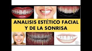 quotANÁLISIS ESTÉTICO FACIAL Y DE LA SONRISAquot [upl. by Macpherson919]