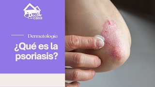 ¿Qué es la psoriasis [upl. by Earaj194]