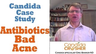 Candida Case Study 6 Aaron Antibiotics and Acne [upl. by Grania]