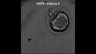 Abnormal cleavage in human IVF embryo [upl. by Mor]