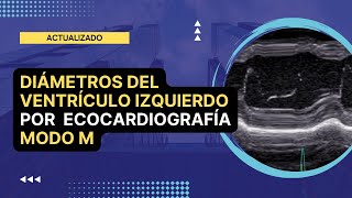 ✅DIAMETROS DEL VENTRICULO IZQUIERDO por Ecocardiografía MODO M 💡Actualizado [upl. by Kreda178]