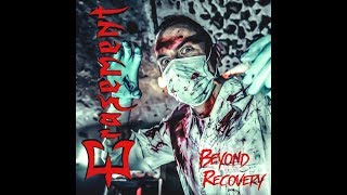 Erasement  Beyond Recovery Full Album 2018 [upl. by Stilu477]