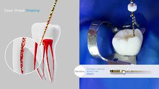 New Protaper Ultimate Maillefer DentsplySirona  Dental Club [upl. by Gyasi307]