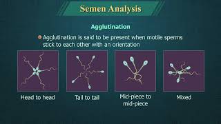 Semen Analysis [upl. by Enelaehs]