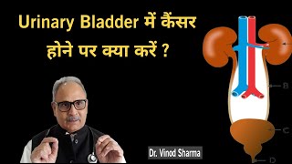 Urinary Bladder में कैंसर होने पर क्या करें Sehat Ki Kunji [upl. by Rem873]