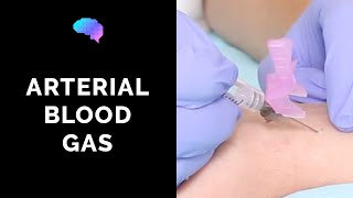 How to take an arterial blood gas ABG  OSCE guide  UKMLA  CPSA [upl. by Natfa905]