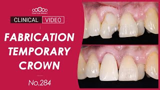 11 crown preparation and Temporary crown setting Dr Na Kiwon [upl. by Nolyaj]