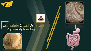 Complete Stool Fecal Analysis تحليل البراز عملى [upl. by Krystin]