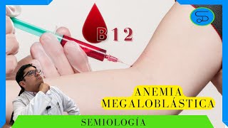 ANEMIA megaloblástica Fisiopatología a tratamiento👨‍⚕️Dr Semio [upl. by Einnaj673]