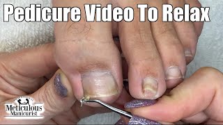 Relaxing Pedicure Toenail Cleaning No Talking Relief for Big Toenail [upl. by Wycoff]