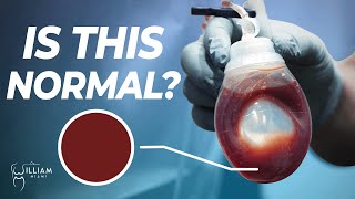 Is This Normal Fluid and Blood in Drains [upl. by Fujio]