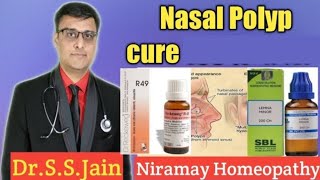 Nasal Polyps  causes symptoms Homeopathic medicine  how to cure naturally [upl. by Jacklyn]