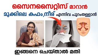 സൈനസൈറ്റിസ് പൂർണ്ണമായി മാറാൻ ഇങ്ങനെ ചെയ്താൽ മതി  Sinusitis Malayalam  Arogyam [upl. by Yleen]