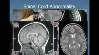 Dr Raymond Perrin The Perrin Technique Part 2 of 6 [upl. by Aoh]