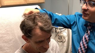 Hair Loss Treatment  Finasteride  Minoxidil  RetinA  UPDATE  Los Angeles [upl. by Ahsykal]