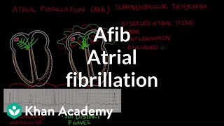 Atrial fibrillation Afib  Circulatory System and Disease  NCLEXRN  Khan Academy [upl. by Htyderem]