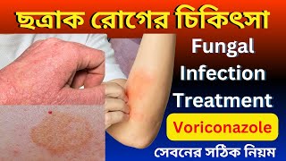 Fungal infection Treatment Bangla  Voriconazole Votab 200 সেবনের সঠিক নিয়ম [upl. by Ynna]