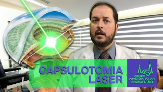 Capsulotomía láser NdYAG [upl. by Ytrebil]